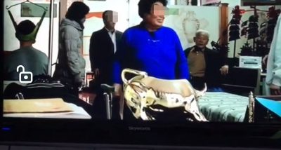 患者案例-治疗后