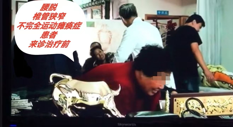 患者案例-治疗前